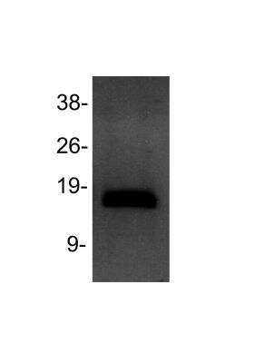 Western Blot: Histone H3 [Dimethyl Lys4] Antibody [NB21-1022] - H3K4Me2 immunoblot in Jurkat cells. Observed molecular weight is ~17 kDa. Image from verified customer review.